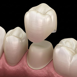 Mobilna i fiksna protetika