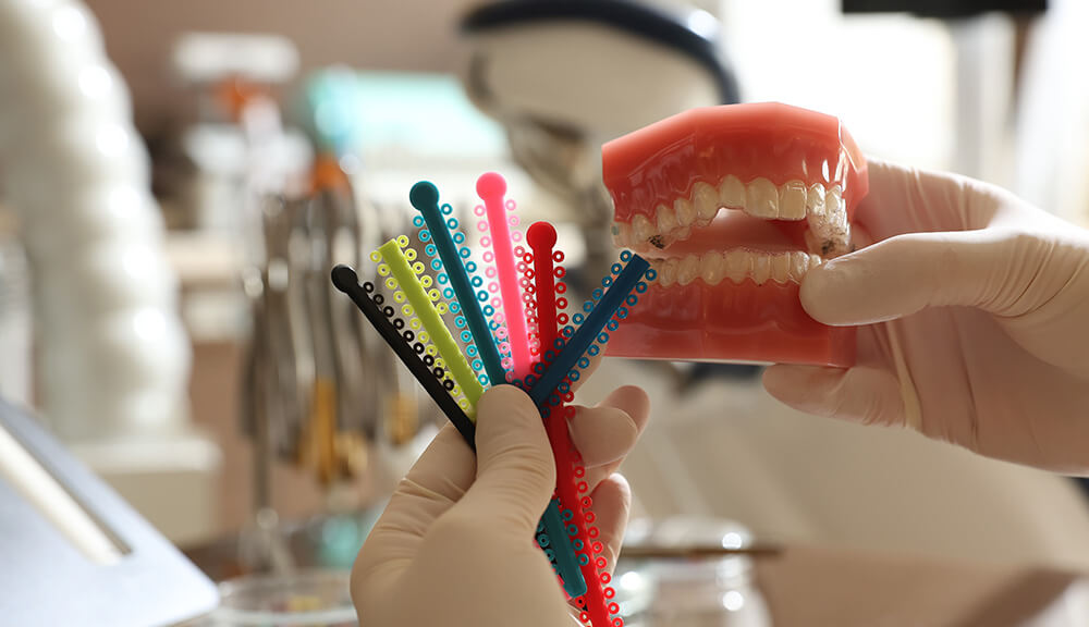 Ortopedija vilica ortodoncija kombinovane tehnike