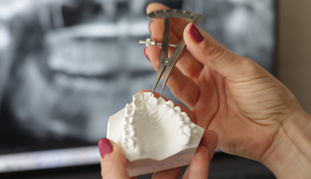 Ortopedija vilica (Ortodoncija)